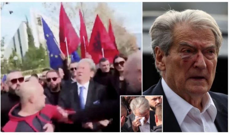 “Iu nxi syri”, Daily Mail për grushtin kundër Berishës: Ish-kreu…