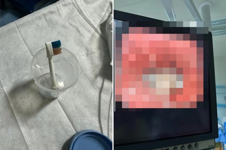 Habiten mjekët, gjejnë furçë dhëmbësh në barkun e 9-vjeçarit