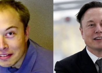 Elon Musk i fixuar, shpenzoi 172 mijë dollarë për t’u dukur më i ri