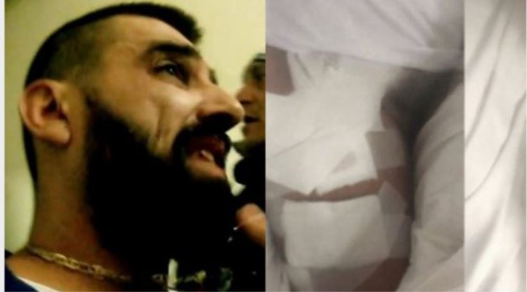 Plagosja në Bllok,më në fund reagon policia:Nuk e fshehëm ngjarjen