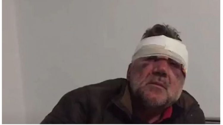 Skandal, mësuesi i akuzuar për ngacmim ishte këshilltar i PS