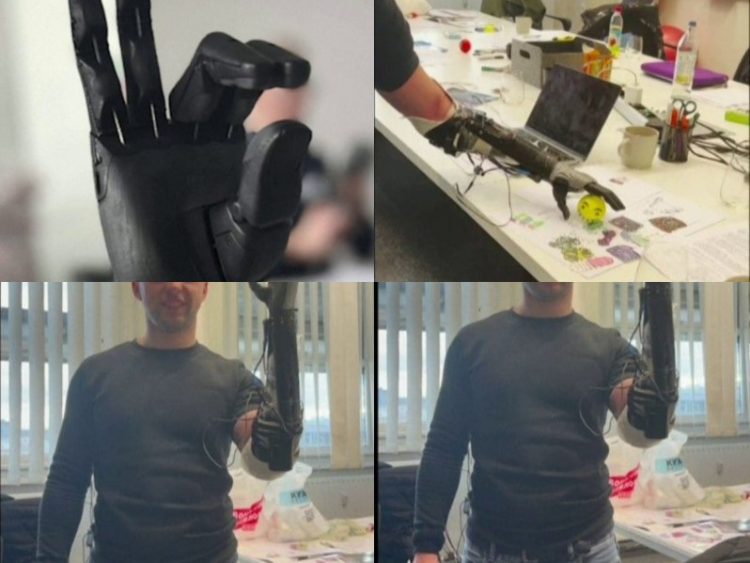 Krahë bionikë për ushtarët ukrainas