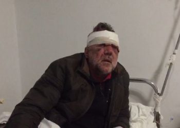 U rrah brutalisht, reagon mësuesi i dhunuar në Tepelenë