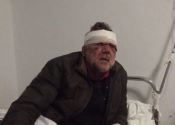 Dhunimi i mësuesit në Tepelenë, reagon policia