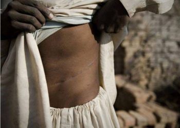 Katër mijë dollorë për një veshkë, si u shkatërrua rrjeti i krimit