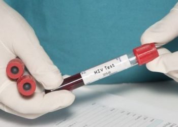 Pacienti gjerman shërohet nga HIV-i