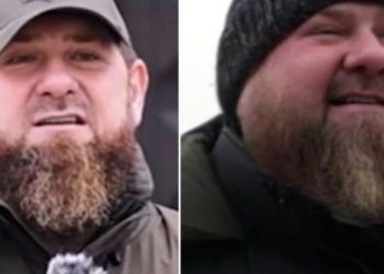 FOTO/ Çfarë po ndodh me liderin çeçen? Ka ndryshuar shumë…