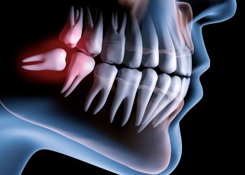 Pse duhet të shqetësohemi kur kemi probleme me dhëmbët