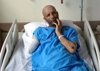 Rrëfimi rrëqethës i 41-vjeçarit turk: Humba këmbët dhe njërën dorë