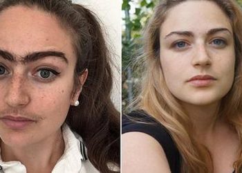 Vajza heq dorë nga depilimi: Ndihem më shumë grua!