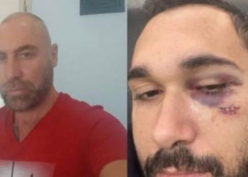 ‘Ta bëj trupin thela-thela’, kush është autori i 2 plagosjeve