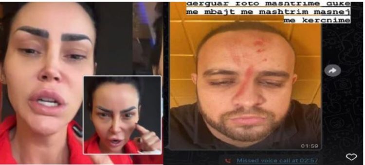 Trondit Fjolla Morina, tregon historinë personale:Jam e shkatërruar