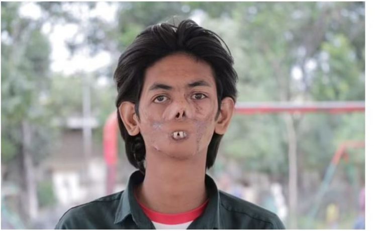 Ujku i hëngri fytyrën, i riu: Njerëzit frikësohen nga unë