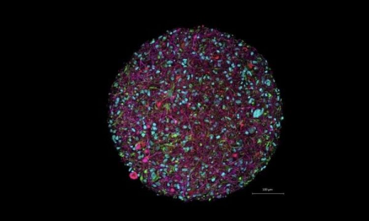 Biokompjuterët e ndërtuar me neuronet njerëzore