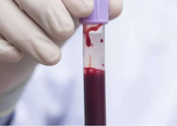 Ja rreziqet e marrjes së gjakut nga grupi i gabuar