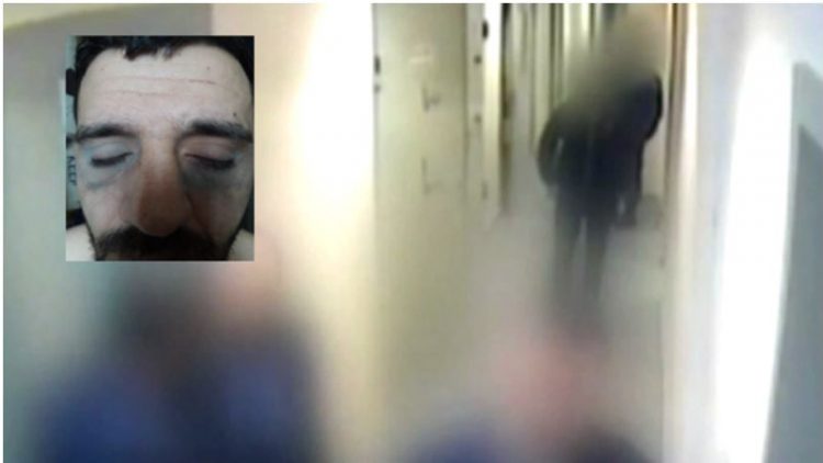 Mediat greke: Si torturohej shqiptari nga policët