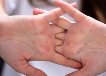 Kërcitja e shpeshtë gishtave, sa e rrezikshme është për shëndetin