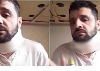 ‘Më kanë sakatuar’, flet shqiptari që u dhunua nga policia greke