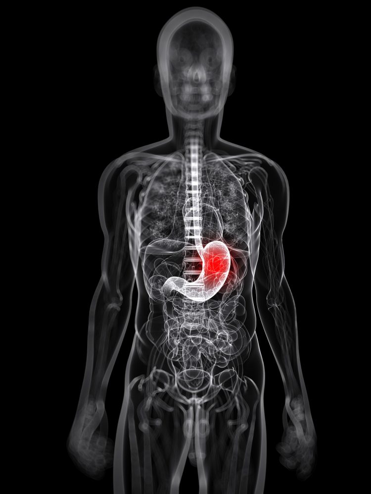 Stomaku, këto simptoma nuk duhen nënvlerësuar