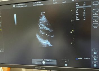 Vetëm 5 raste në botë, shqiptari me zemrën në krah të djathtë