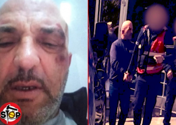 Policia e Lezhës arreston dhe keqtrajton qytetarin, i nxin sytë