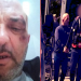 Policia e Lezhës arreston dhe keqtrajton qytetarin, i nxin sytë