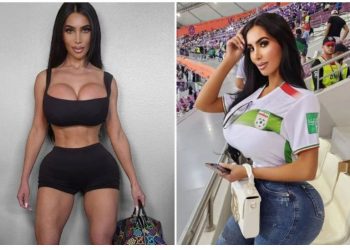 Vdes gjatë operacionit plastik sozia e Kim Kardashian