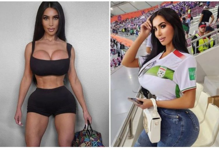 Vdes gjatë operacionit plastik sozia e Kim Kardashian