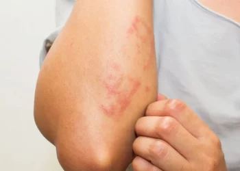 Rastet kur lëkura paralajmëron sëmundje