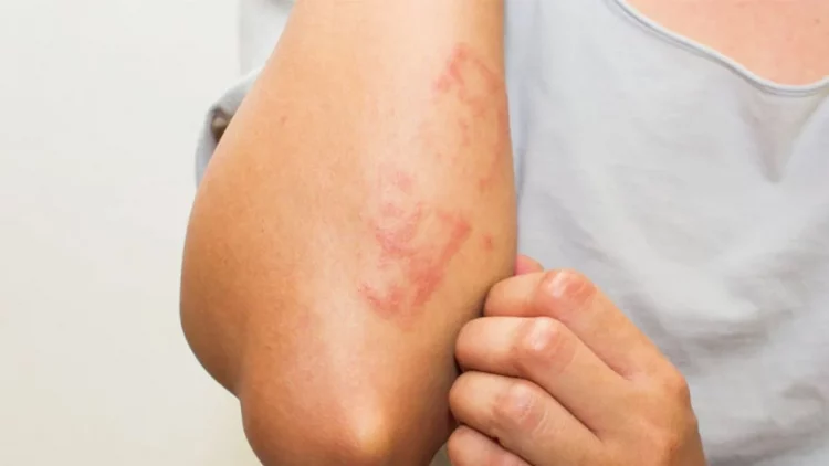 Rastet kur lëkura paralajmëron sëmundje