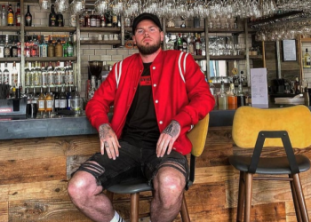 I bëri lekët “rrush e kumbulla”, ja si ka përfunduar ishi i “The Reds”