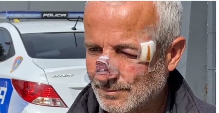 Zgjedhjet, plas sherri në Bashkinë e Patosit (FOTO)