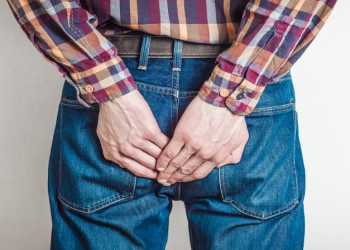 Sinusi pilonidal ose kisti i mbushur nga prania e qimeve të rrënjosura