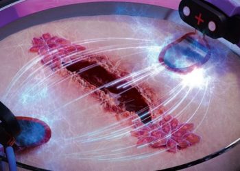 Studimi: Elektriciteti mund t’i shërojë plagët 3 herë më shpejt