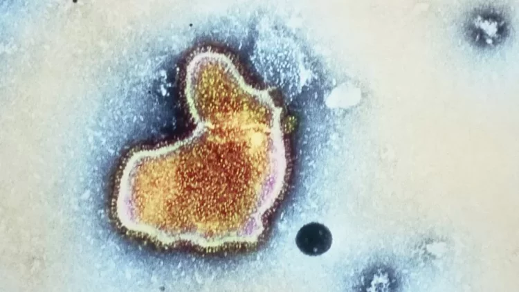 SHBA aprovon vaksinën e parë kundër virusit respirator