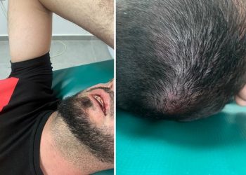 Gjakoset aktivisti i PD në Fushë Arrëz