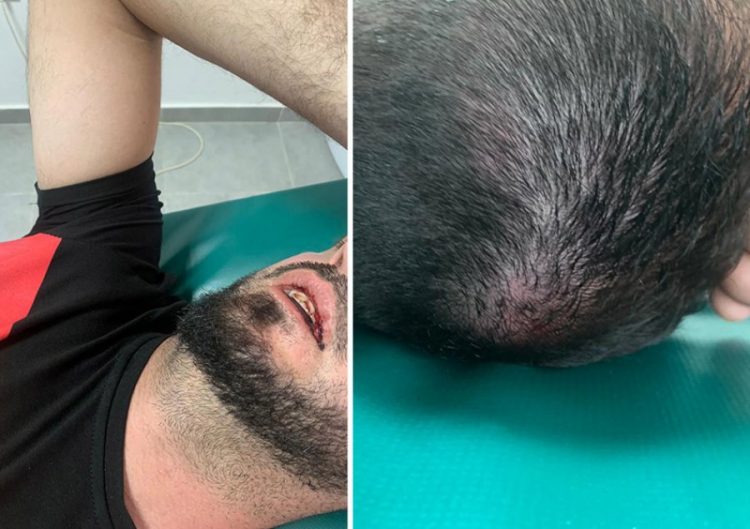 Gjakoset aktivisti i PD në Fushë Arrëz