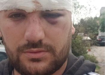 Sherr në Kishën e Laçit, rojet private përplasen me shitësit ambulantët