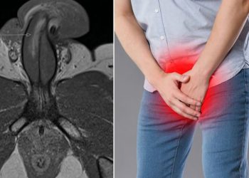 36-vjeçari “thyen” penisin e tij në 3 vende gjatë aktit seksual