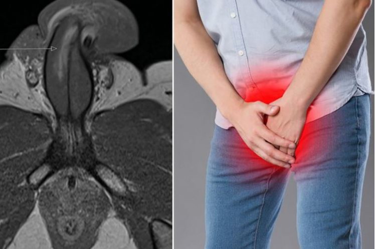 36-vjeçari “thyen” penisin e tij në 3 vende gjatë aktit seksual