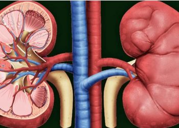 Si ndikon rritja e temperaturave te personat që vuajnë nga gurët në veshka