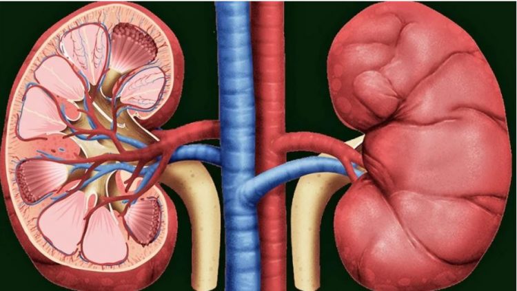 Si ndikon rritja e temperaturave te personat që vuajnë nga gurët në veshka