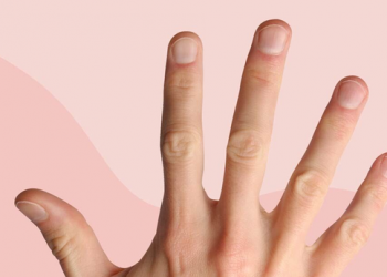 Ja çfarë tregon ngjyra e thonjve për shëndetin tënd