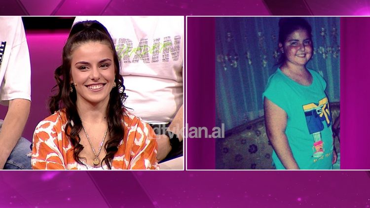 Pinte 20 kokrra kortizon në ditë, arriti në 99 kg në moshën 15-vjeçare/ Historia e Anxhelës