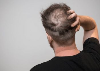 Ja disa udhëzime për të evituar rënien e flokëve