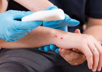 Çfarë duhet të bëni nëse ju kafshon gjarpri