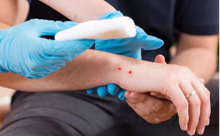 Çfarë duhet të bëni nëse ju kafshon gjarpri