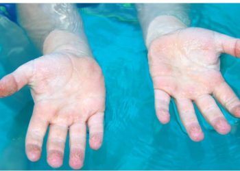 Pse rrudhen gishtat në ujë?