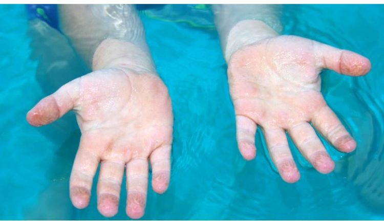 Pse rrudhen gishtat në ujë?