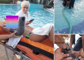 FOTO/ Fëmijës i ngeci dora te tubi pishinës, ndërhyjnë zjarrfikësit